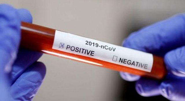 Koronavirüs Vaka, Hasta ve ölü sayısı açıklandı