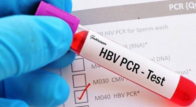 Türkiye 15 ülkenin vatandaşından PCR testi istemeyecek