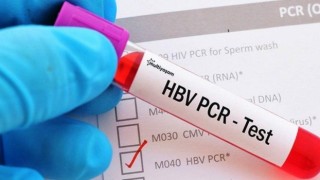 Türkiye 15 ülkenin vatandaşından PCR testi istemeyecek