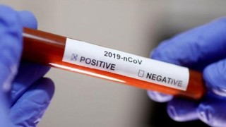 Son dakika haberi: Sağlık Bakanlığı tarafından 22 Eylül koronavirüs tablosu, vaka, hasta, test, vefat sayısı ve son durum açıklandı.